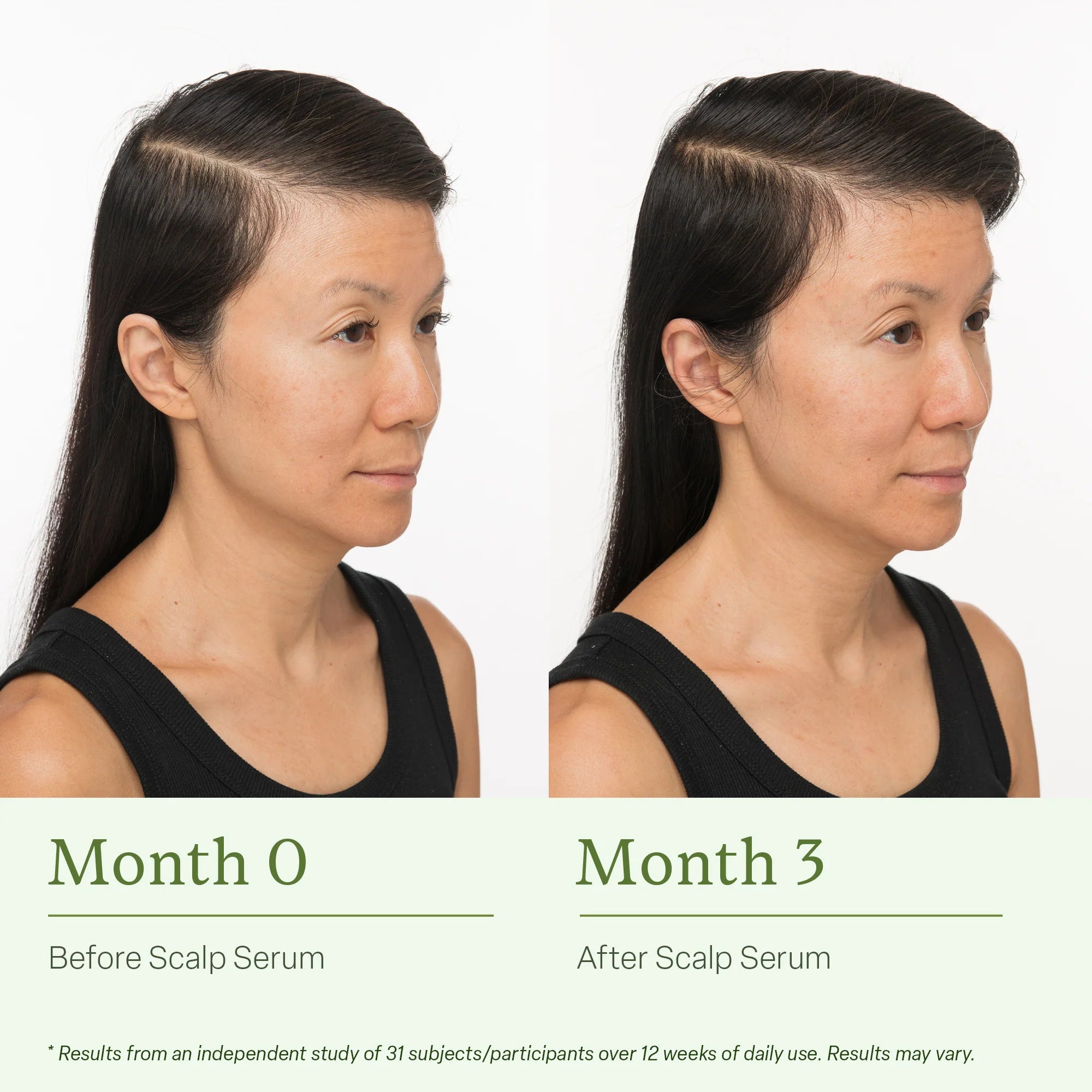 30Ml Scalp Serum
